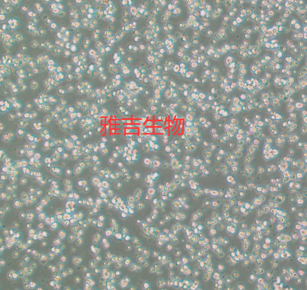人弥漫性大B淋巴瘤细胞TMD8（带STR鉴定）